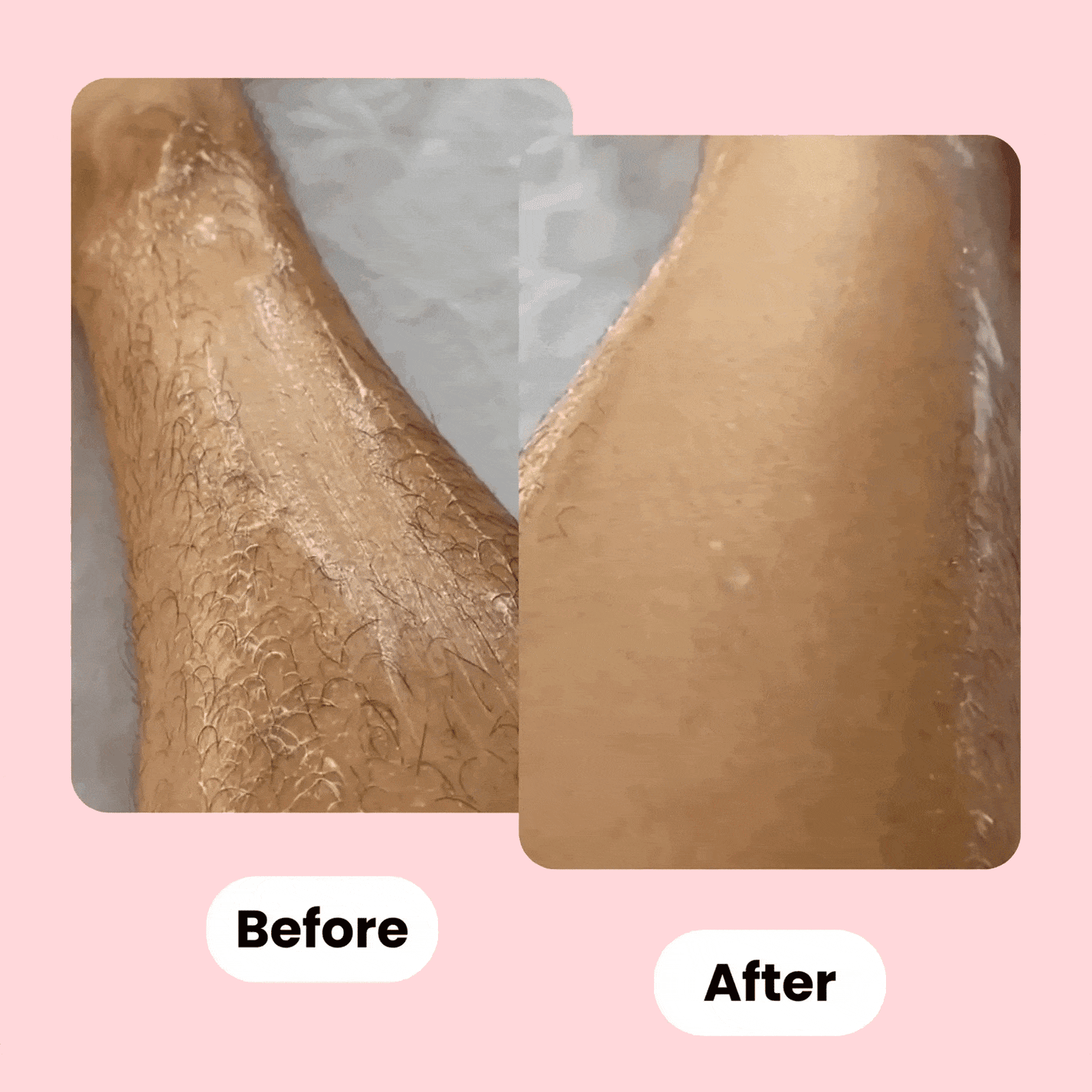 SmoothRazor™ | #1 scheermes voor een zachte en gladde huid