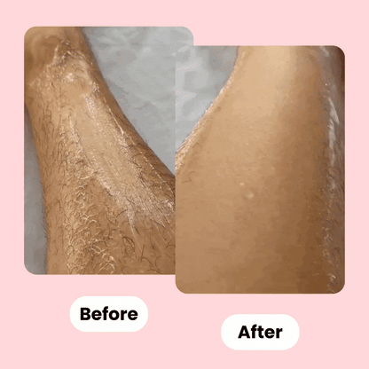 SmoothRazor™ | #1 scheermes voor een zachte en gladde huid