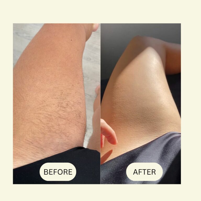 SmoothRazor™ | #1 scheermes voor een zachte en gladde huid