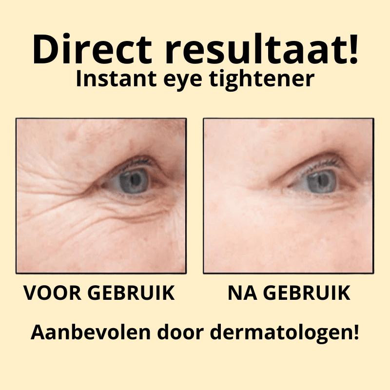 Instant eye tightener - aanbevolen door dertmatologen