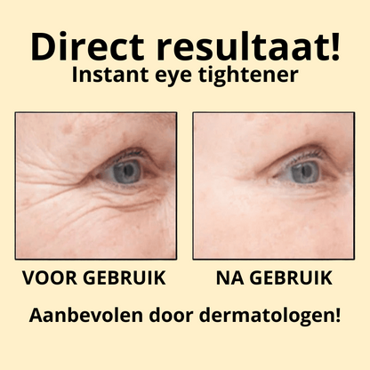 Instant eye tightener - aanbevolen door dertmatologen