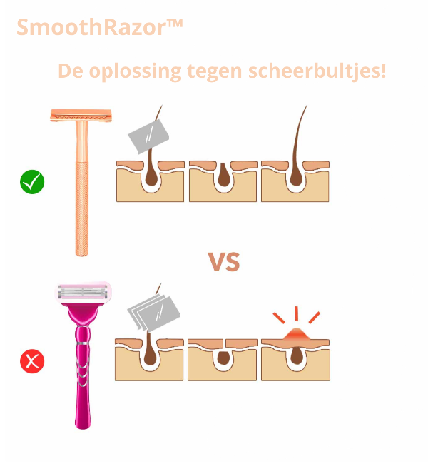 SmoothRazor™ | #1 scheermes voor een zachte en gladde huid