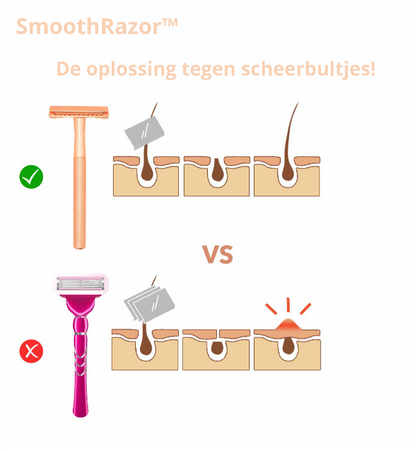 SmoothRazor™ | #1 scheermes voor een zachte en gladde huid