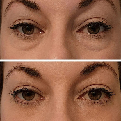 Instant eye tightener - aanbevolen door dertmatologen