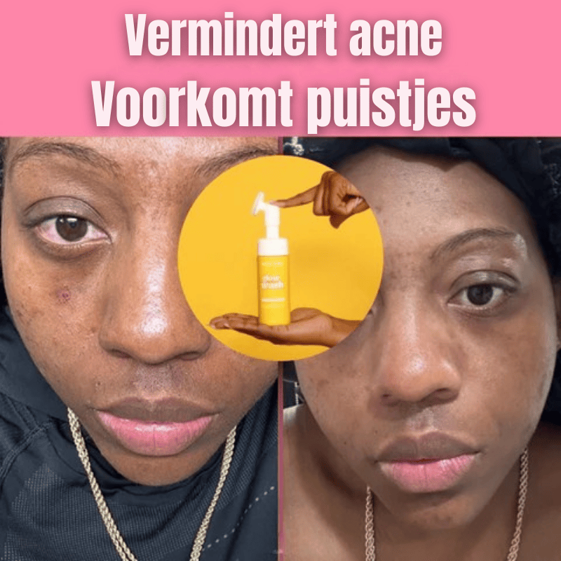 VIRAL Turmeric & Kojic Acid Glow Wash
