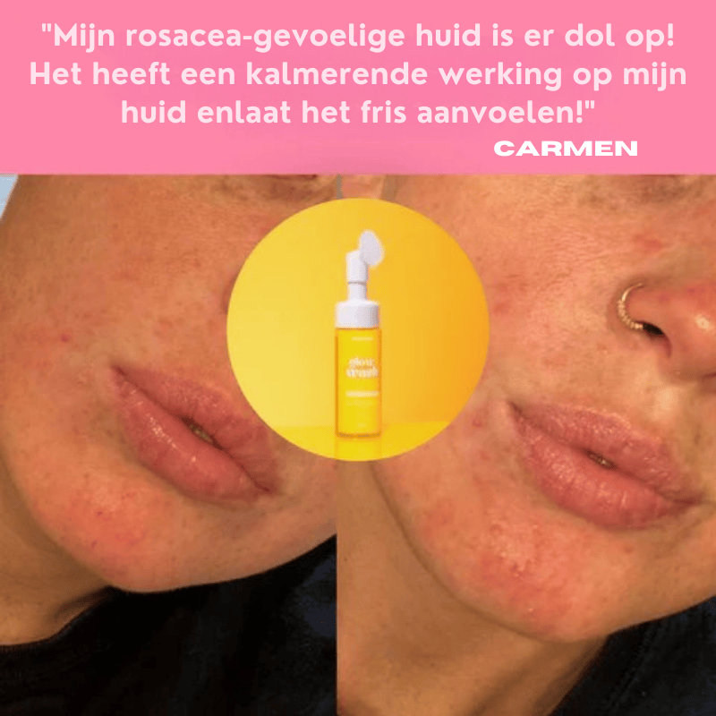 VIRAL Turmeric & Kojic Acid Glow Wash