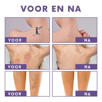 Meilou - Vlekkeloze huid in seconden