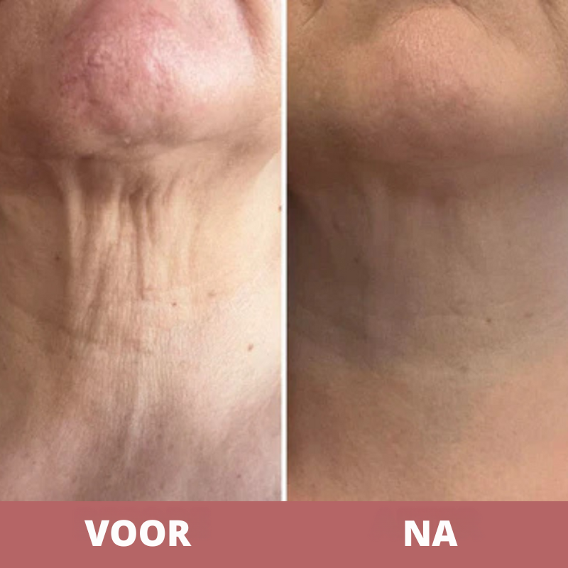 CocoBeauty™ - Tighten & lift neck cream