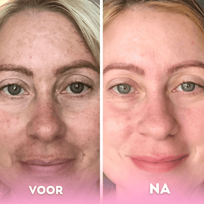 Turmeric Kojic Acid Pads